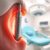 Implantologia stomatologiczna: co warto wiedzieć o implantach?